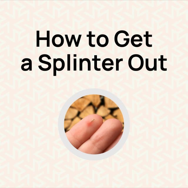 How to Get a Splinter Out