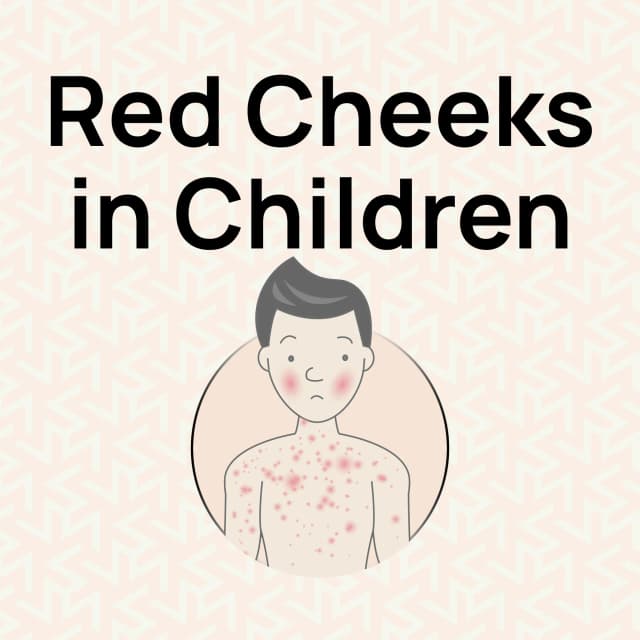 red-cheeks-in-children-uk-guide-hurak